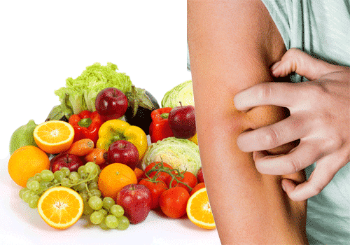 psoriasi-alimentazione