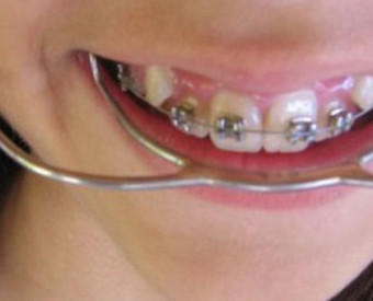 omeopatia-salute-rimedi-intossicazioni