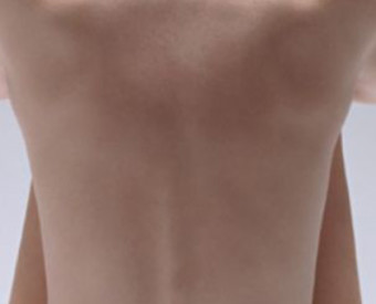 omeopatia-salute-dolori-alla-schiena