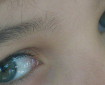 omeopatia-salute-salute-occhio-prevenzione-iniziare-piccoli