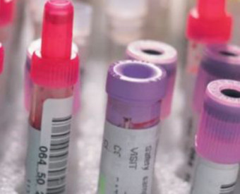 omeopatia-salute-test-HPV