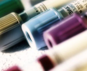 omeopatia-salute-test-mucca-pazza